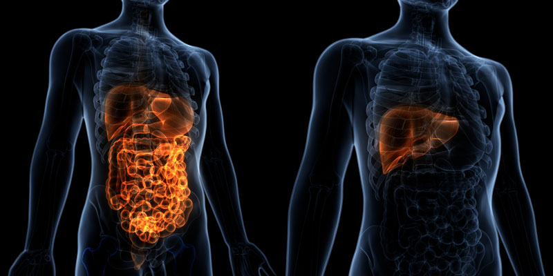 easl-fatty-liver-high-risk-cancer