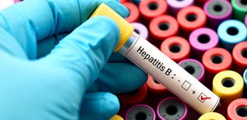 The WHO Guidelines For Chronic Hepatitis B Fail Treatment