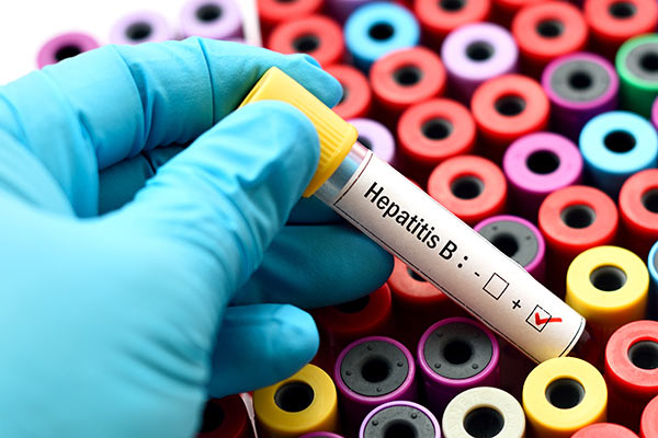 The Who Guidelines For Chronic Hepatitis B Fail To Detect Half Of