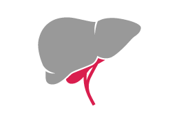liver-cancer-cirrhosis