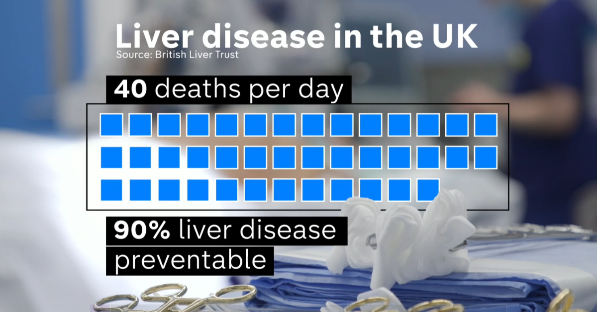 Liver disease in UK - 40 deaths per day (source - British Liver Trust)